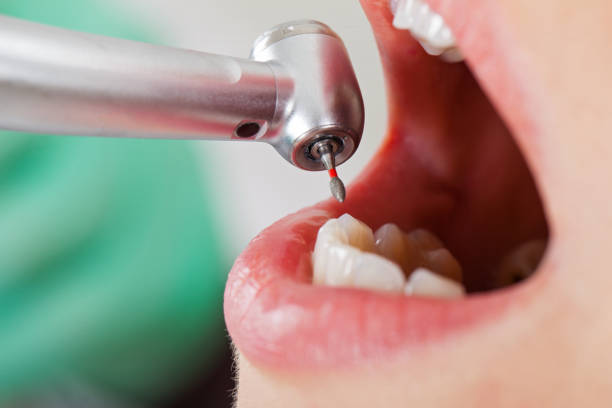 Best Weekend Emergency Dentist in Locust Grove, OK